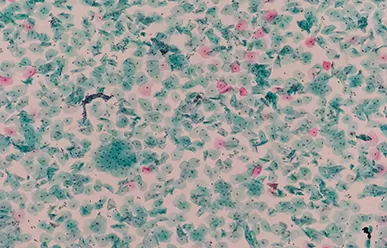 Faktoren, die das Verblassen bemalter Rutschen beeinflussen